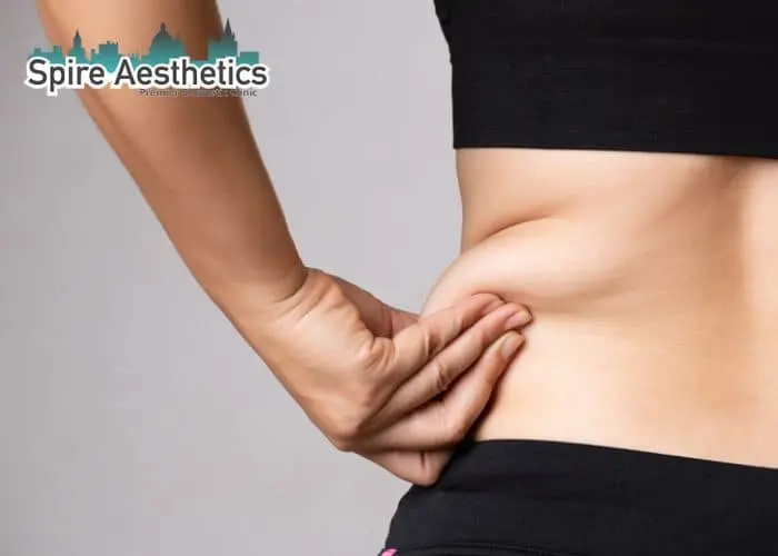 Image of woman pinching fat on their hips High Wycombe. Fat Freezing treatment