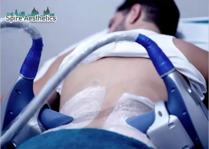 Man having fat freezing treatment done on love handles before a competitions High Wycombe to create a sculpted look.