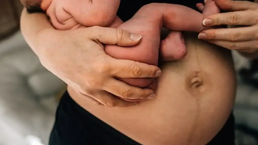Why Is My Stomach Still Big After Pregnancy High Wycombe?
