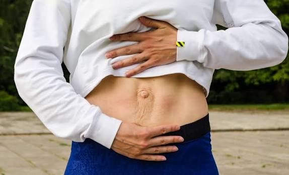 When Could Diastasis Recti Be the Missing Piece of the Puzzle High Wycombe?